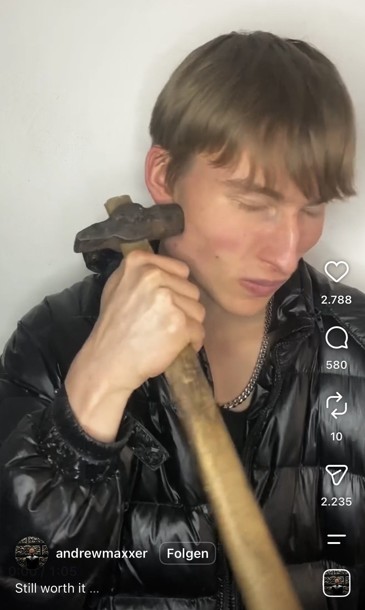 Looksmaxxing-Trend: Warum junge Männer sich für Schönheit ins Gesicht schlagen